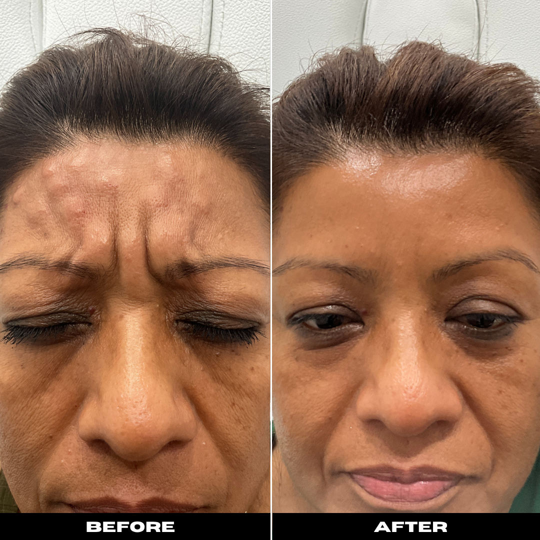 Before and After Image: Tox - front
