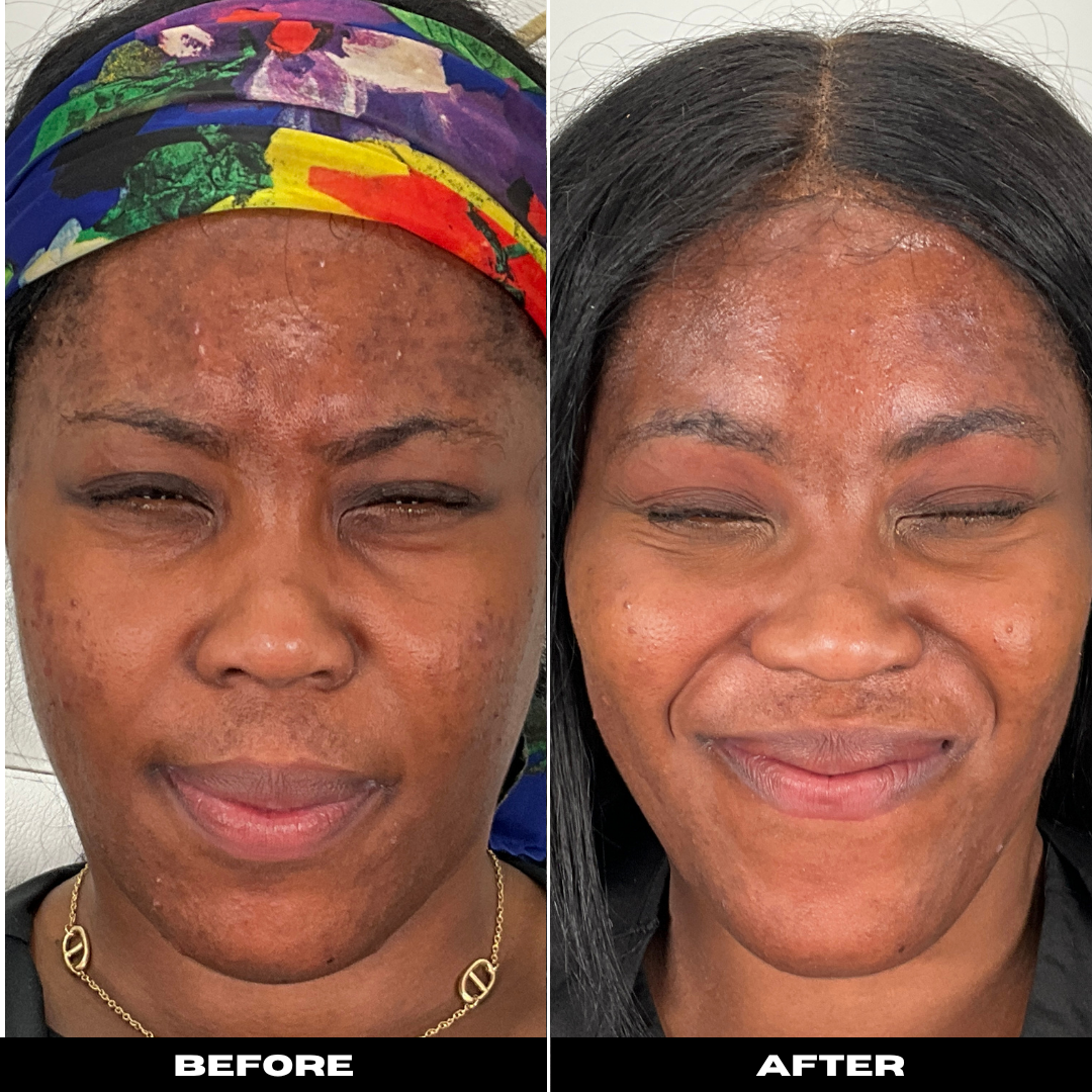 Before and After Image: Tox - front