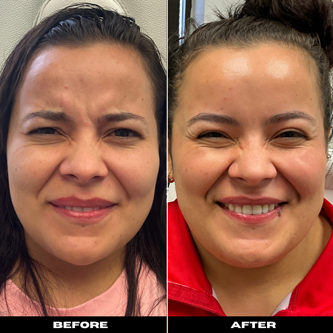 Before and After Image: Tox - front